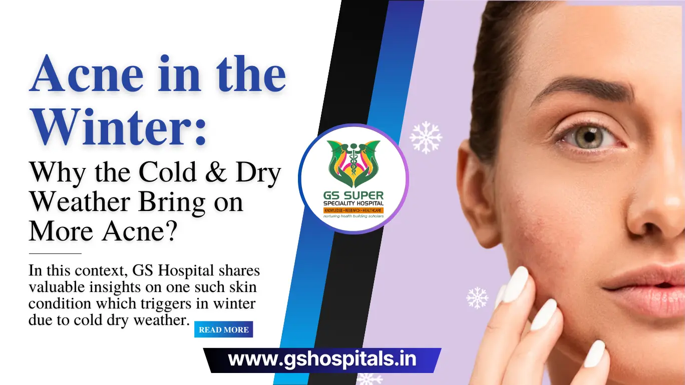 Acne in the Winter: Why the Cold & Dry Weather Bring on More Acne?