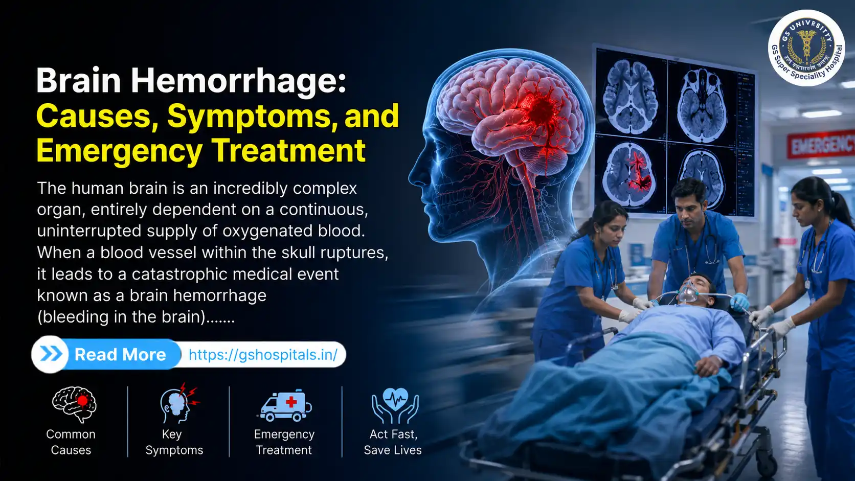 Brain Hemorrhage: Causes, Symptoms, and Emergency Treatment