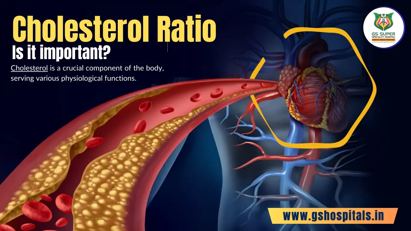 Cholesterol Ratio: Is it important?