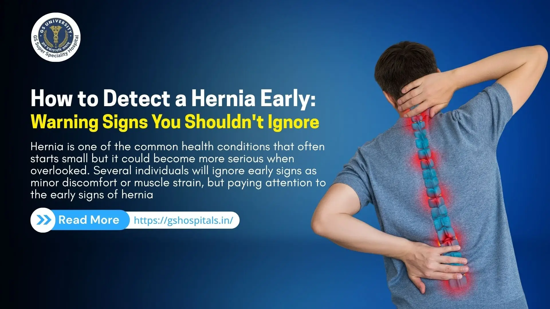 How to Detect a Hernia Early: Warning Signs You Shouldn't Ignore