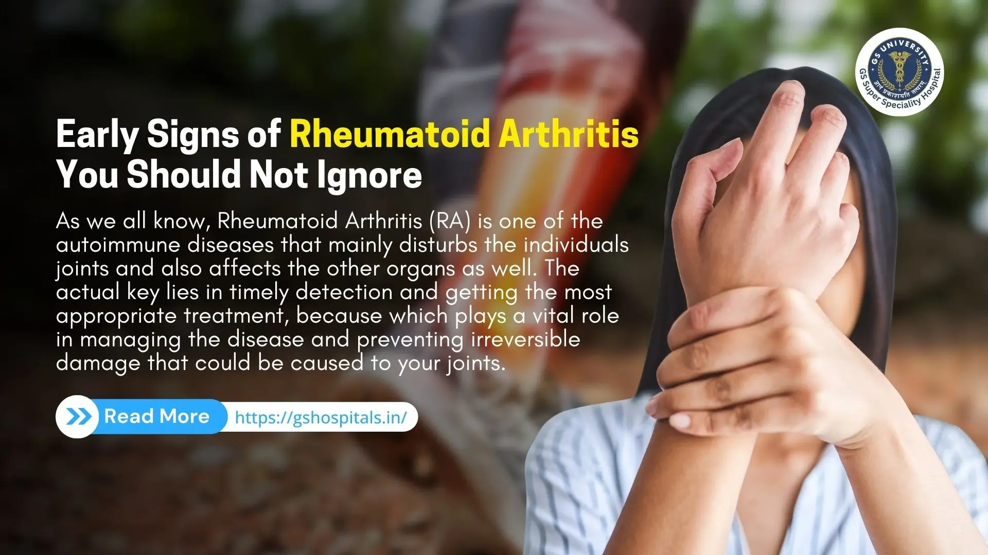 Early Signs of Rheumatoid Arthritis You Should Not Ignore