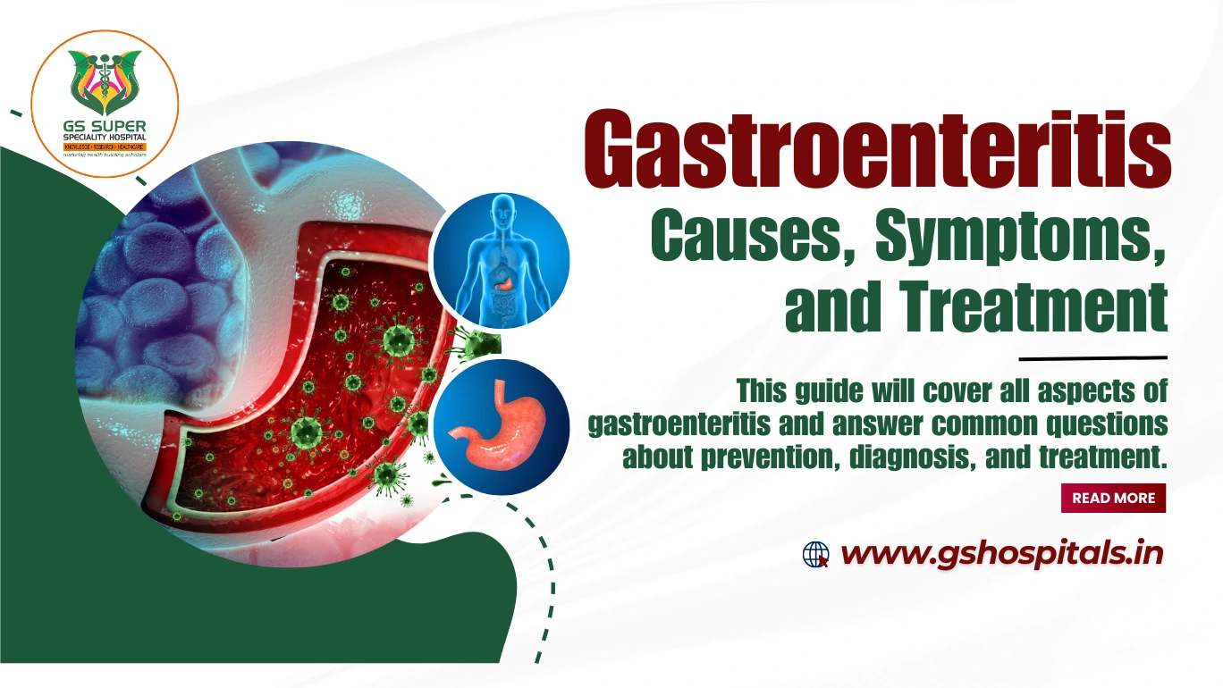 Gastroenteritis - Causes, Symptoms, and Treatment