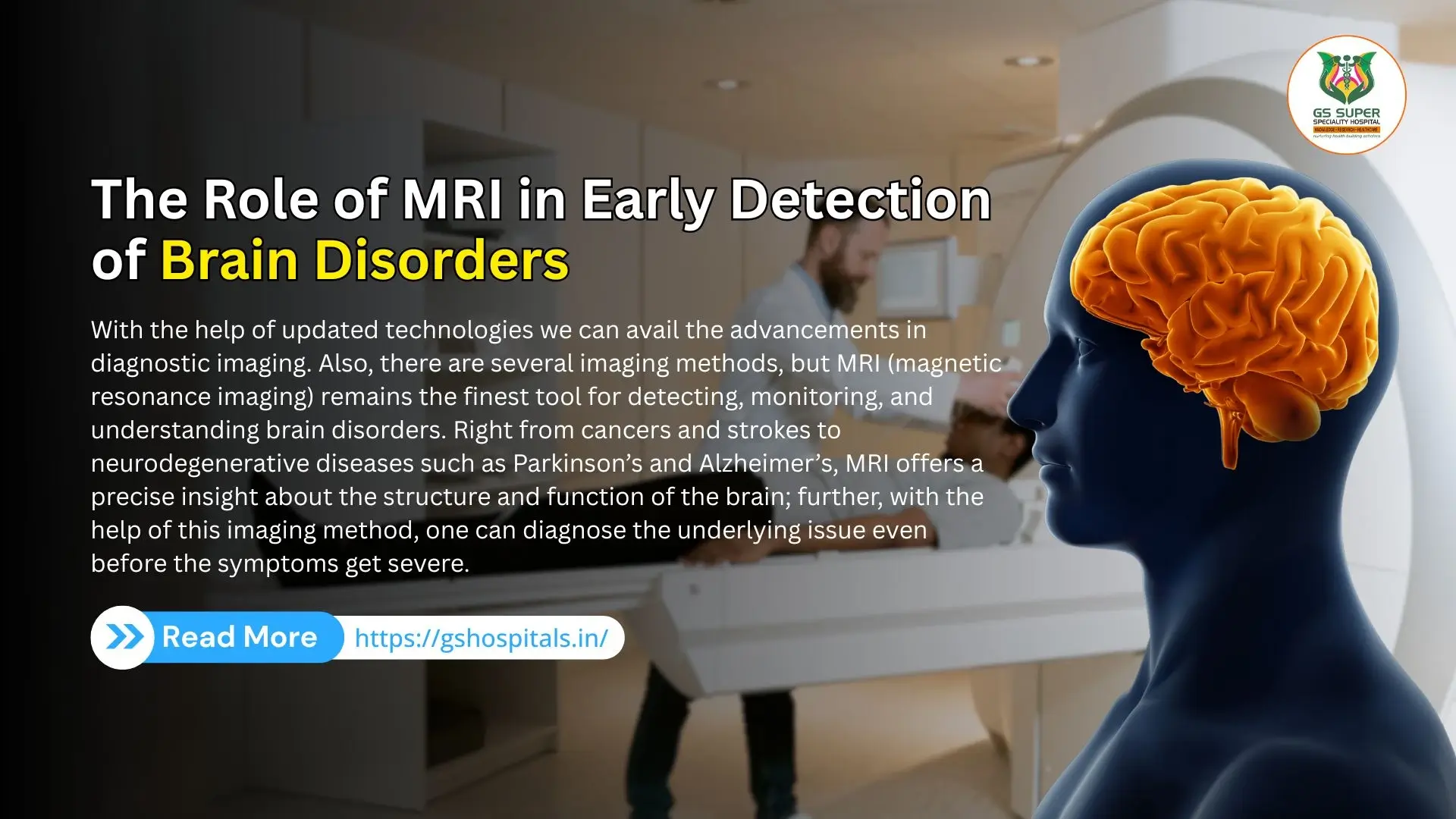 The Role of MRI in Early Detection of Brain Disorders