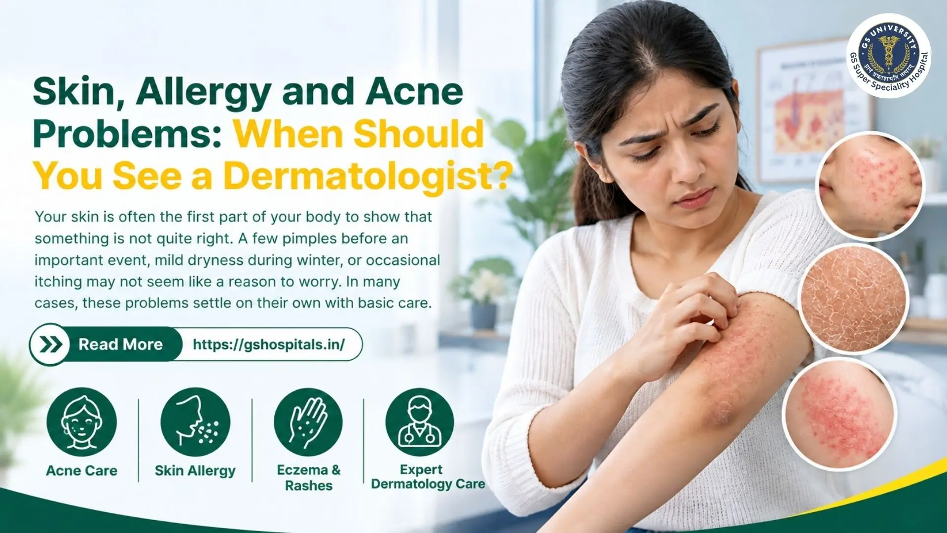 Skin, Allergy and Acne Problems: When Should You See a Dermatologist?