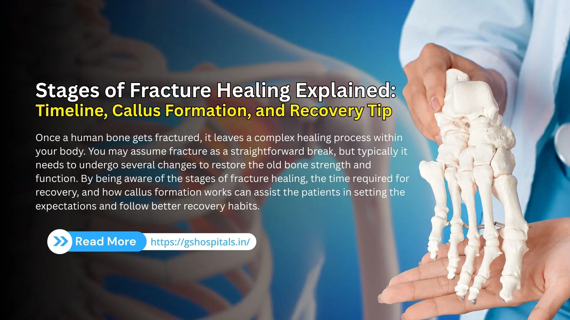 Stages of Fracture Healing Explained: Timeline, Callus Formation, and Recovery Tip