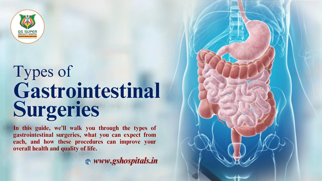 Types of Gastrointestinal Surgeries: What You Need to Know