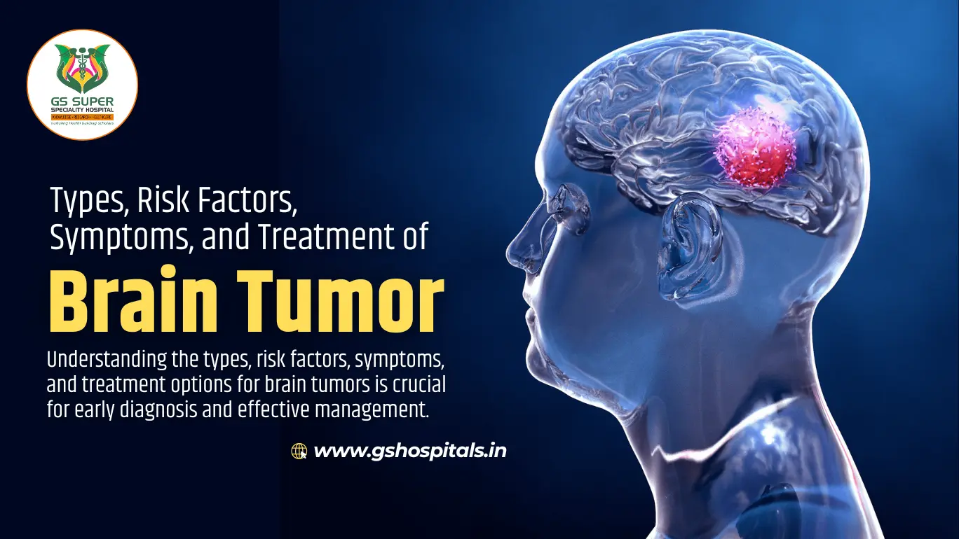 Types, Risk Factors, Symptoms, and Treatment of Brain Tumor