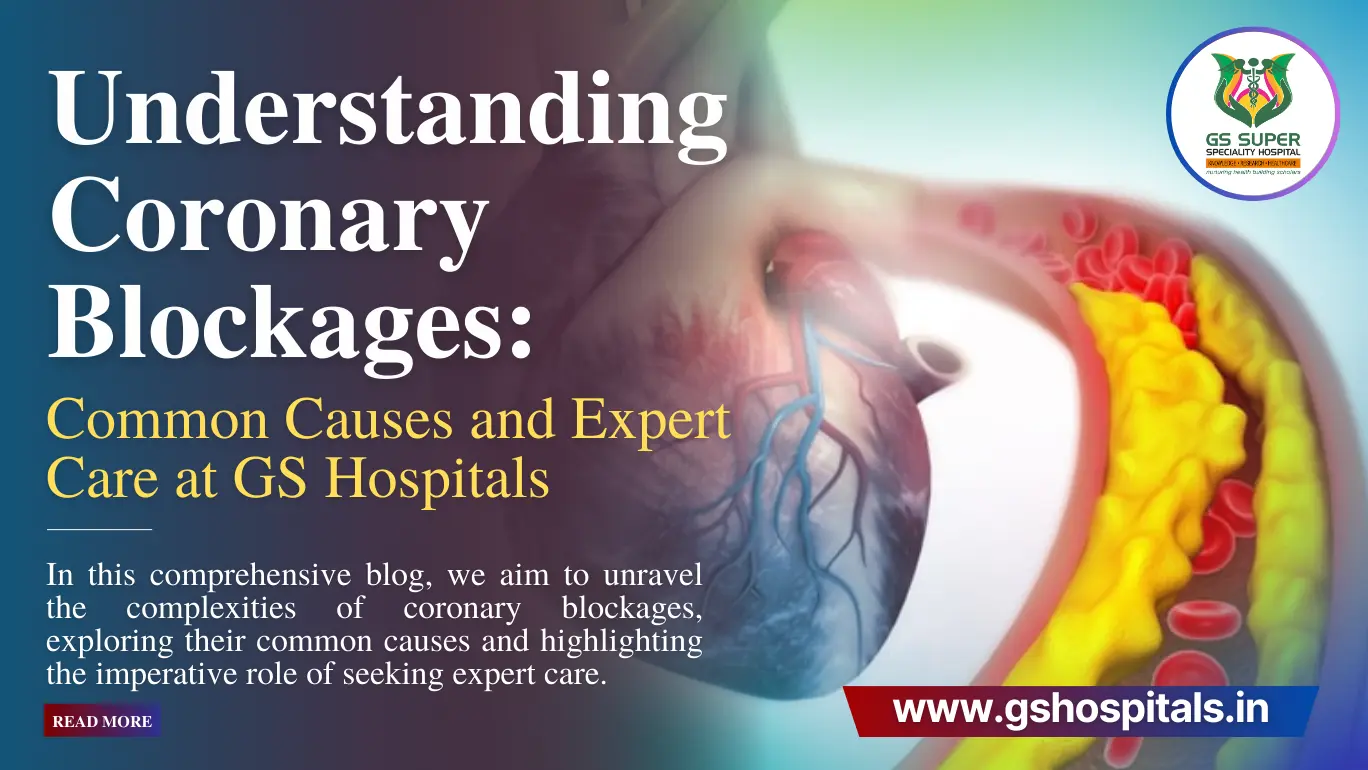 Understanding Coronary Blockages: Common Causes and Expert Care at GS Hospitals